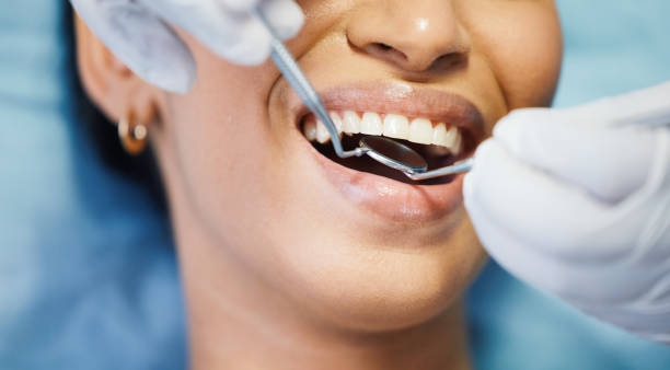 Best Emergency Wisdom Tooth Extraction in Hidden Meadows, CA